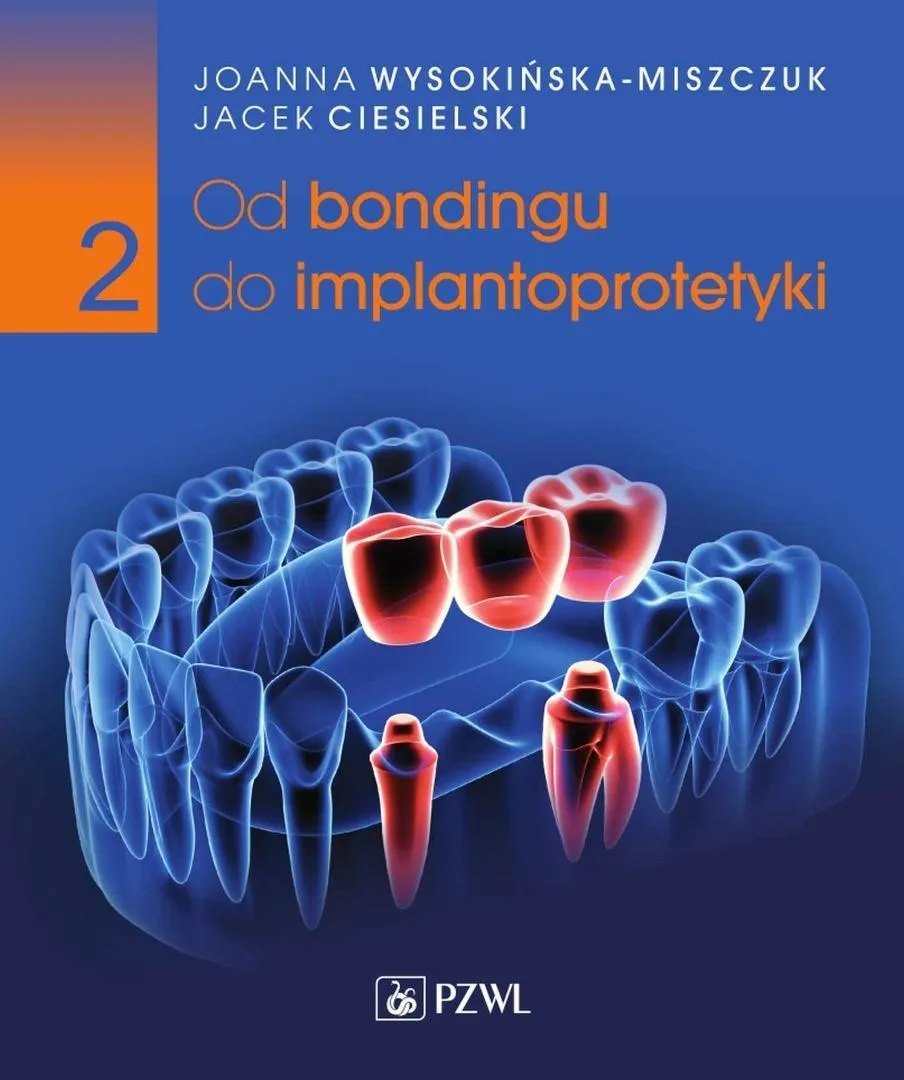 od-bondingu-do-implantoprotetyki-cz-2