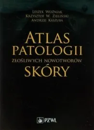 atlas-patologii-zlosliwych-nowotworow-skory