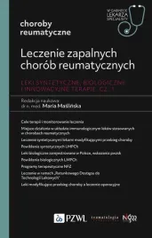 leczenie-zapalnych-chorob-reumatycznych