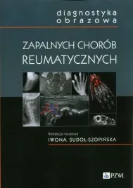 diagnostyka-obrazowa-zapalnych-chorob