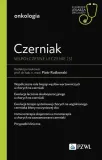 czerniak-wspolczesne-leczenie-5