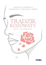 tradzik-rozowaty-bez-tajemnic