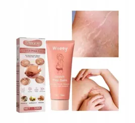 balsam-do-ciala-korygujacy-rozstepy-wiieey