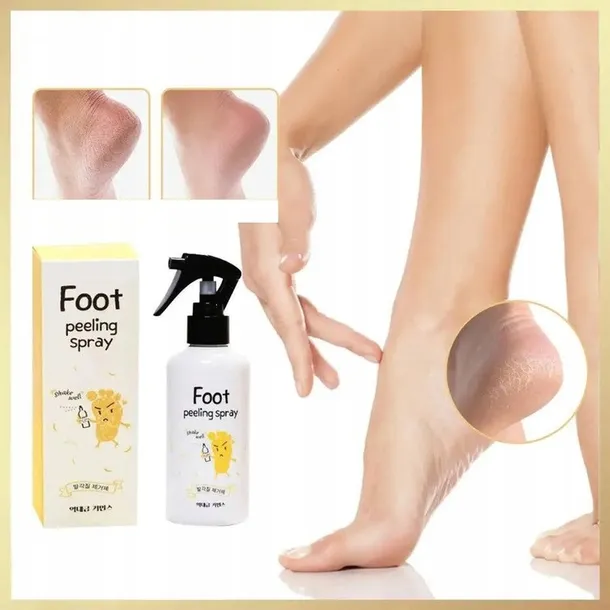 peeling-w-spray-u-do-stop-piet-zmiekcza-zluszcza-pielegnuje-200-ml-marka-bez-marki