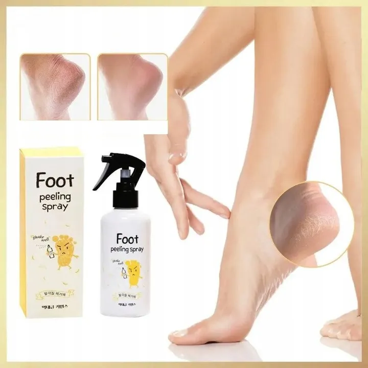 peeling-w-spray-u-do-stop-piet-zmiekcza-zluszcza-pielegnuje-200-ml