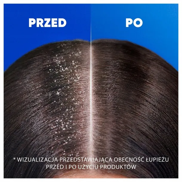 head-and-shoulders-classic-clean-szampon-800ml-wyrob-medyczny-nie