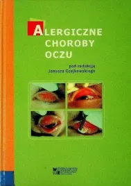 alergiczne-choroby-oczu-red-janusz-czajkowski