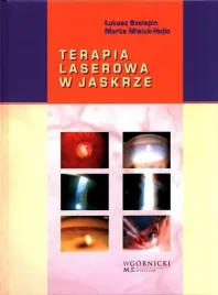 terapia-laserowa-w-jaskrze