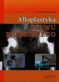 alloplastyka-stawu-biodrowego-andrzej-pozowski