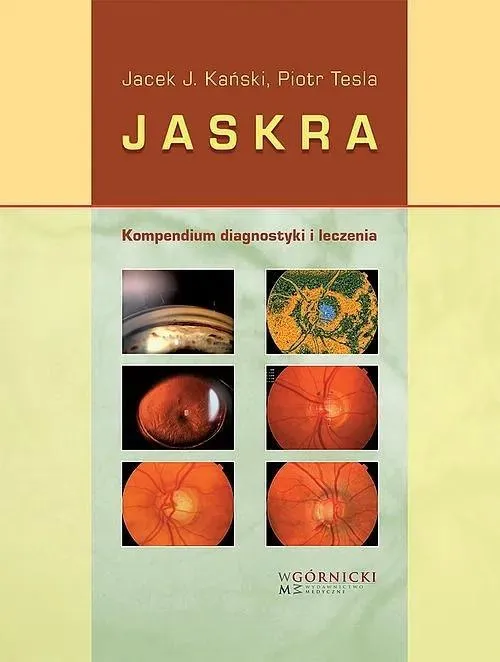 jaskra-kompendium-diagnostyki-i-terapii