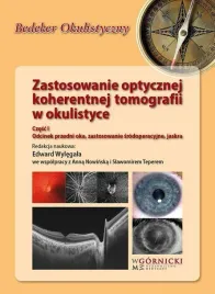 zastosowanie-optycznej-koherentnej-tomografii-cz-1