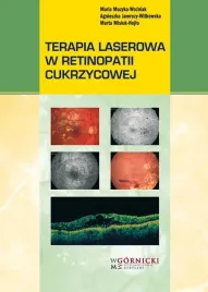 terapia-laserowa-w-retinopatii-cukrzycowej