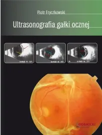 ultrasonografia-galki-ocznej-piotr-fryczkowski
