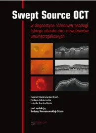 swept-source-oct-w-diagnostyce-patologii-tylnego