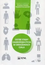 ostre-stany-zagrozenia-zycia-w-obrazeniach-ciala