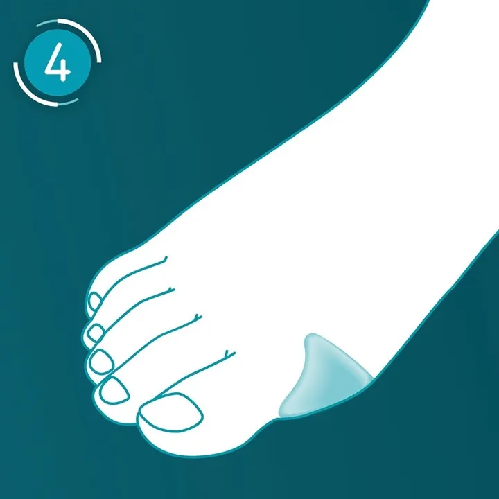 compeed-plastry-na-halluksy-5-szt-x2