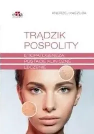 tradzik-pospolity-etiopatogeneza-postacie-andrzej-kaszuba