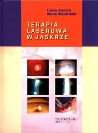 terapia-laserowa-w-jaskrze-lukasz-szelepin-marta-misiuk-hojlo