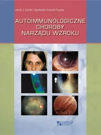 autoimmunologiczne-choroby-narzadu-wzroku-jacek-j-kanski-agnieszka-kubick