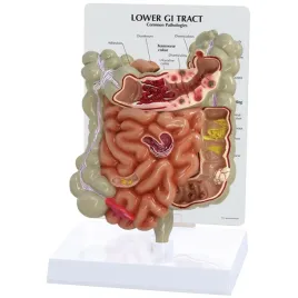model-przewodu-pokarmowego-3b-scientific-gpi-anatomicals