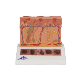 model-raka-skory-3b-scientific-j15-rozne-etapy-14-cm-10-cm-1143-cm