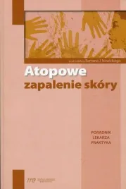 atopowe-zapalenie-skory-poradnik-lekarza-praktyka