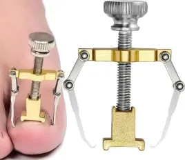 klamra-korekcyjna-na-wrastajace-paznokcie-wrosniety-paznokiec-u-stopy