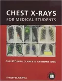 chest-x-rays-for-medical-students
