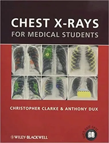 chest-x-rays-for-medical-students