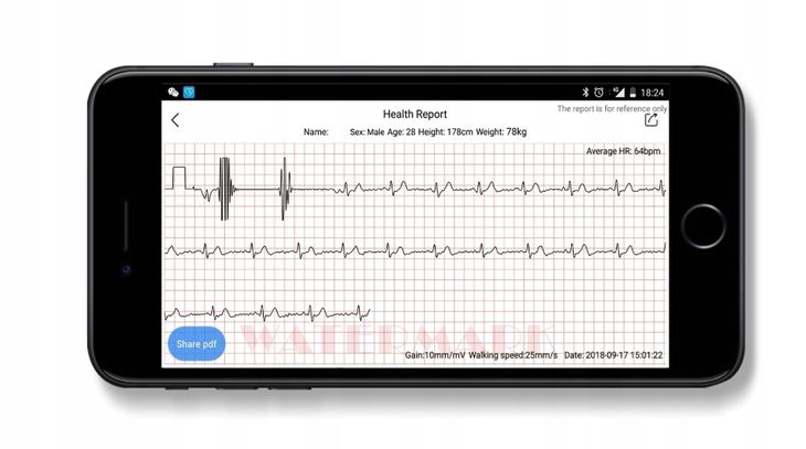 p11 smartband