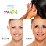 otostick-korektory-odstajace-uszy-maskowanie-wlasciwosci-inne