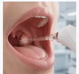 zent-tonsilcare-urzadzenie-do-czyszczenia-higieny-migdalkow-i-gardla