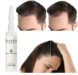 serum-przeciw-wypadaniu-wlosow-ampulki-na-porost-wlosow-carin-botea-10ml