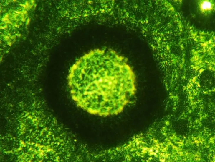 sok-z-jeczmienia-mlodego-bio-500g-natvita-sproszkowany-raw-witaminy-cechy-dodatkowe-bez-cukru-bez-jodu-bez-kazeiny-bez-laktozy-bezalkoholowy-chronic-przed-swiatlem-czysty-bez-dodatkow-weganski-wegetarianski-ekologiczny-bez-aspartamu