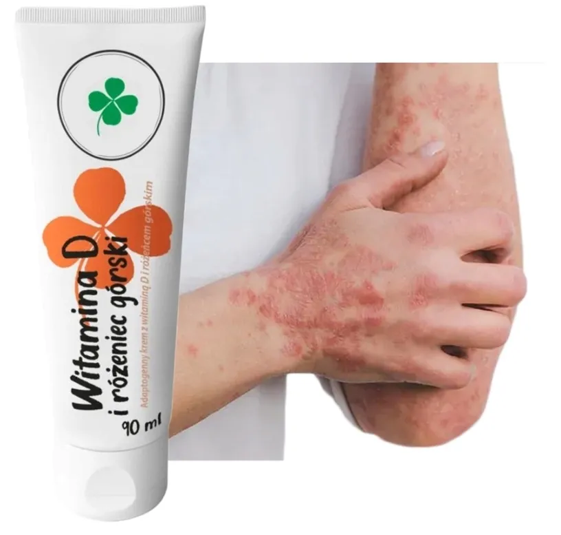 krem-witamina-d-rozeniec-gorski-90ml