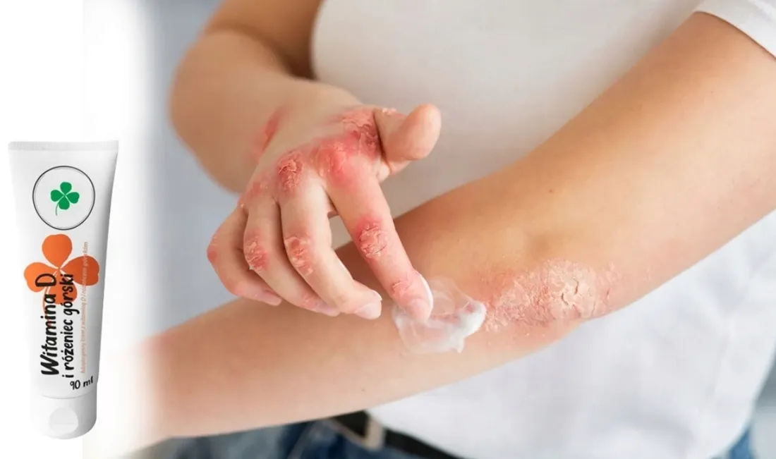 krem-witamina-d-rozeniec-gorski-90ml-stan-nowy