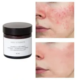 lagodzaca-masc-z-nagietkiem-i-arnika-regenerujaca-pielegnacja-prezent