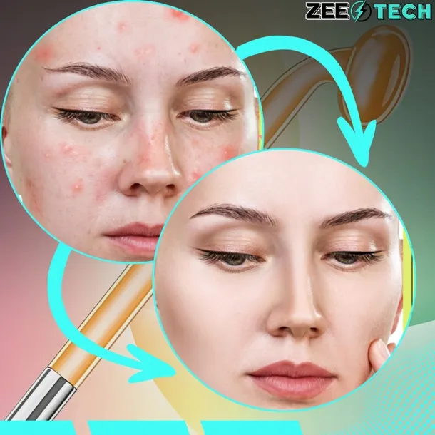 darsonval-derma-wand-4-peloty-elektrody-pielegnacja-twarzy-skory-wlosow-10w-zasilanie-sieciowe