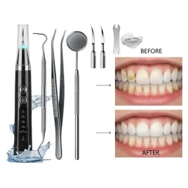 skaler-dentystyczny-ultrasoniczny-domowe-usuwanie-kamienia-z-zebow