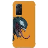etui-antishock-do-xiaomi-redmi-note-11-space-wzory