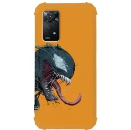 etui-antishock-do-xiaomi-redmi-note-11-space-wzory