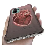 etui-antishock-do-xiaomi-redmi-note-10s-top-wzory