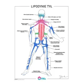 plakat-anatomiczny-lipodynie-tyl-bez-ramki-30x40-cm-skladowski