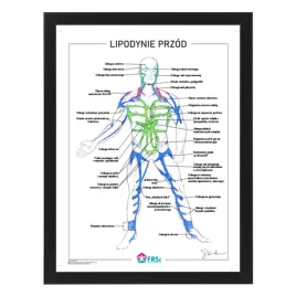 plakat-anatomiczny-lipodynie-przod-w-ramce-33x43-cm-skladowski