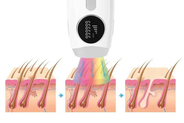 depilator-ipl-krexus-cialo-bikini-pro-5-trybow-stan-nowy