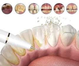 skaler-ultradzwiekowy-dentystyczny-do-zebow-mocny-usuwanie-kamienia