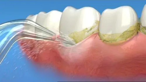 ladowarka-sieciowa-usb-do-irygatora-dentystycznego-marka-pds-stan-nowy-kod-producenta-char