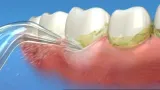 ladowarka-sieciowa-usb-do-irygatora-dentystycznego-marka-pds-stan-nowy-kod-producenta-char