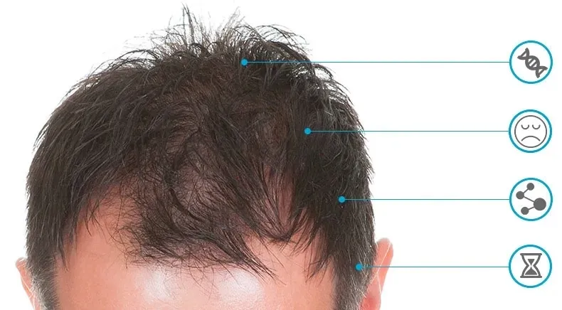 szampon-alopel-150ml-stan-nowy