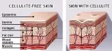 profesjonalne-ampulki-na-cellulit-12x10ml-nowosc-stan-nowy